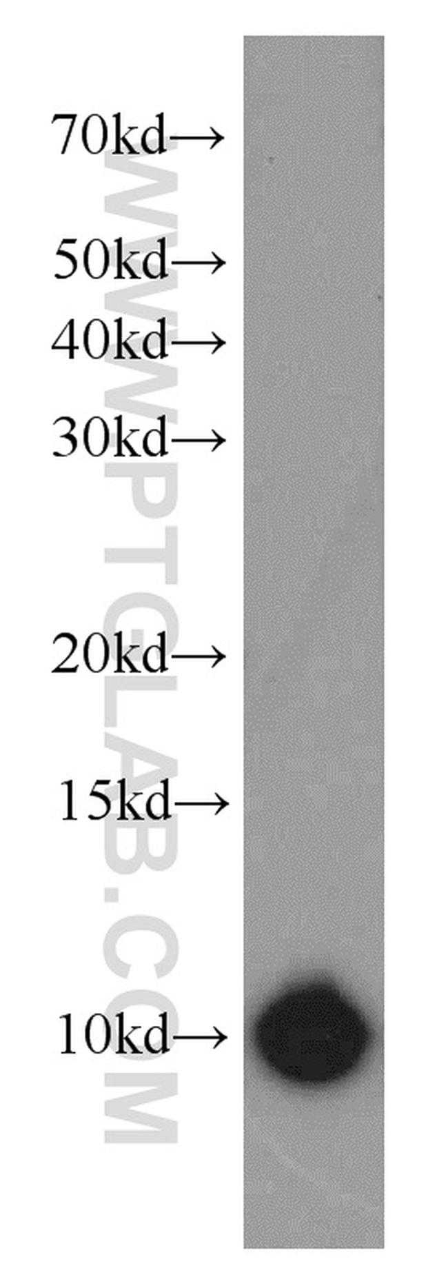 S100A1 Antibody in Western Blot (WB)