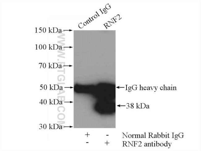 RNF2 Antibody in Immunoprecipitation (IP)