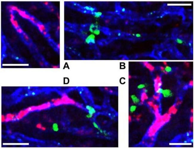 CD31 (PECAM-1) Antibody in Immunohistochemistry (IHC)