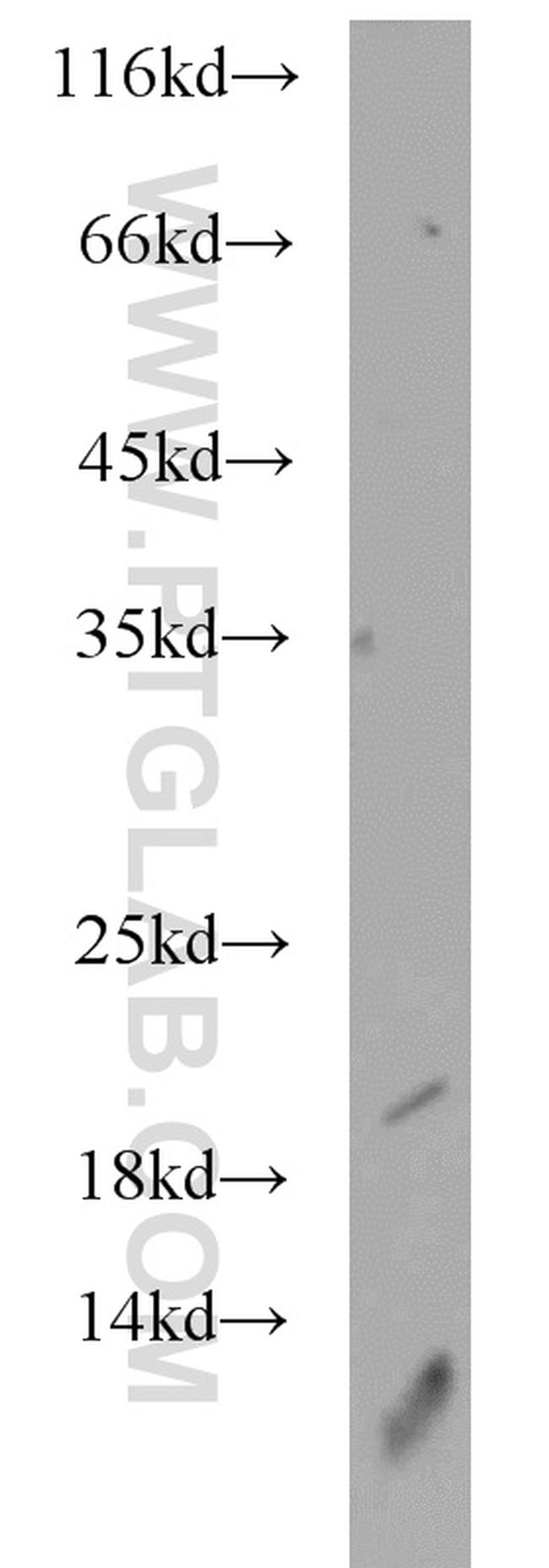 SRP19 Antibody in Western Blot (WB)