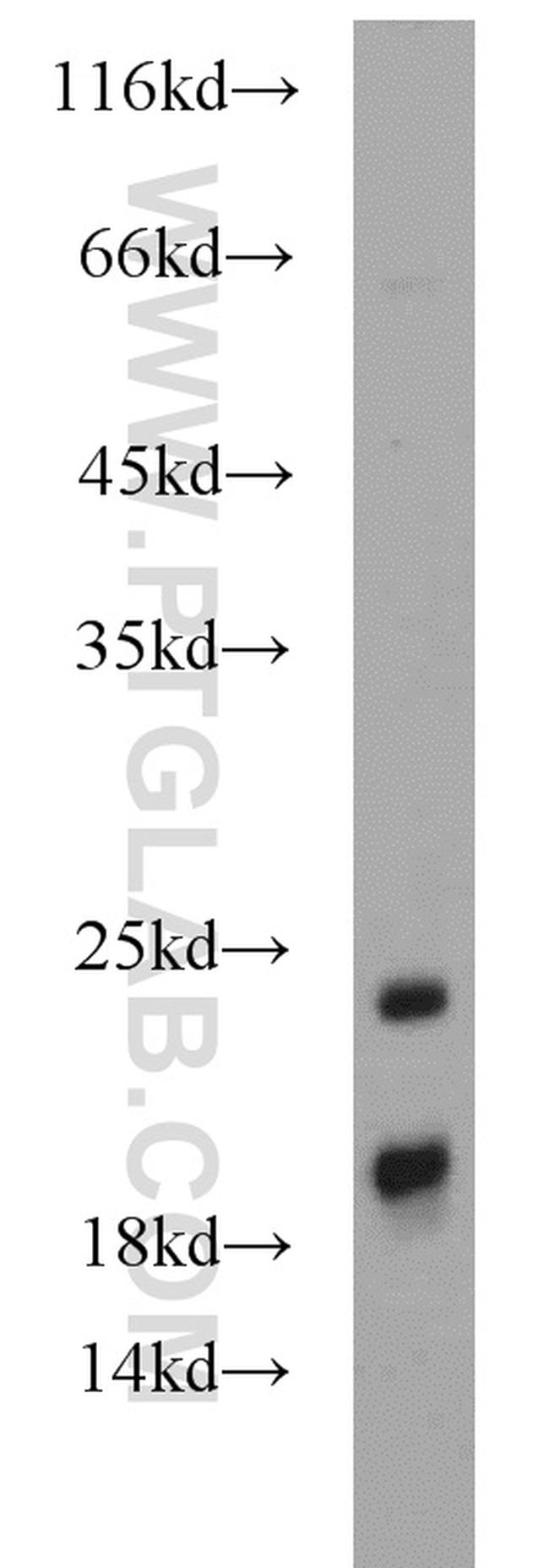 SRP19 Antibody in Western Blot (WB)