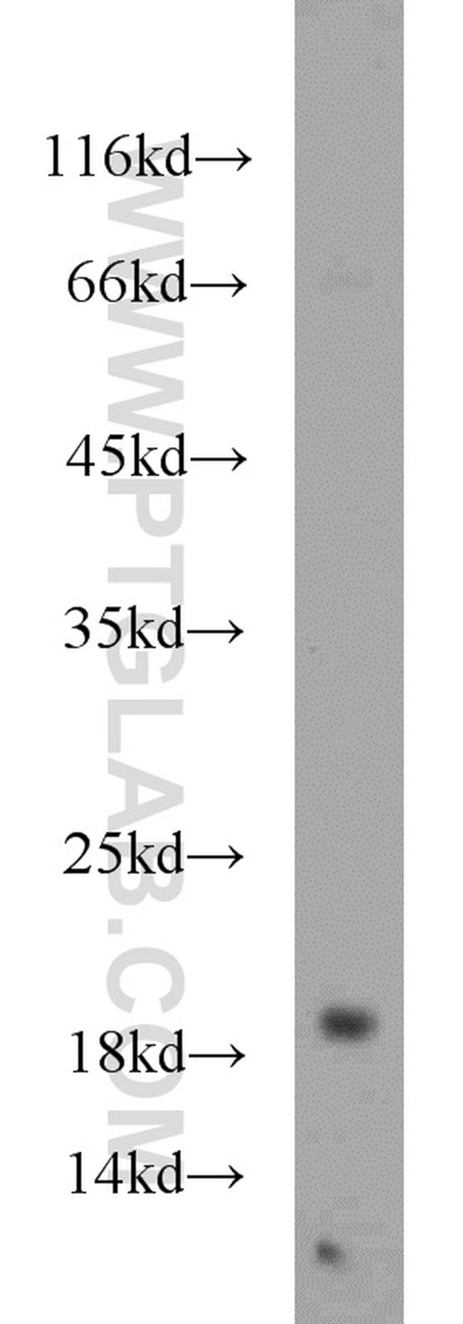 SRP19 Antibody in Western Blot (WB)