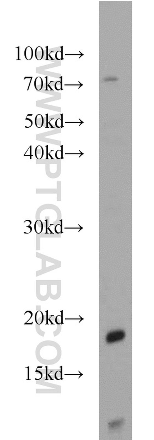 SRP19 Antibody in Western Blot (WB)