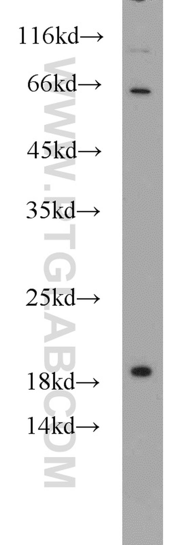 SRP19 Antibody in Western Blot (WB)