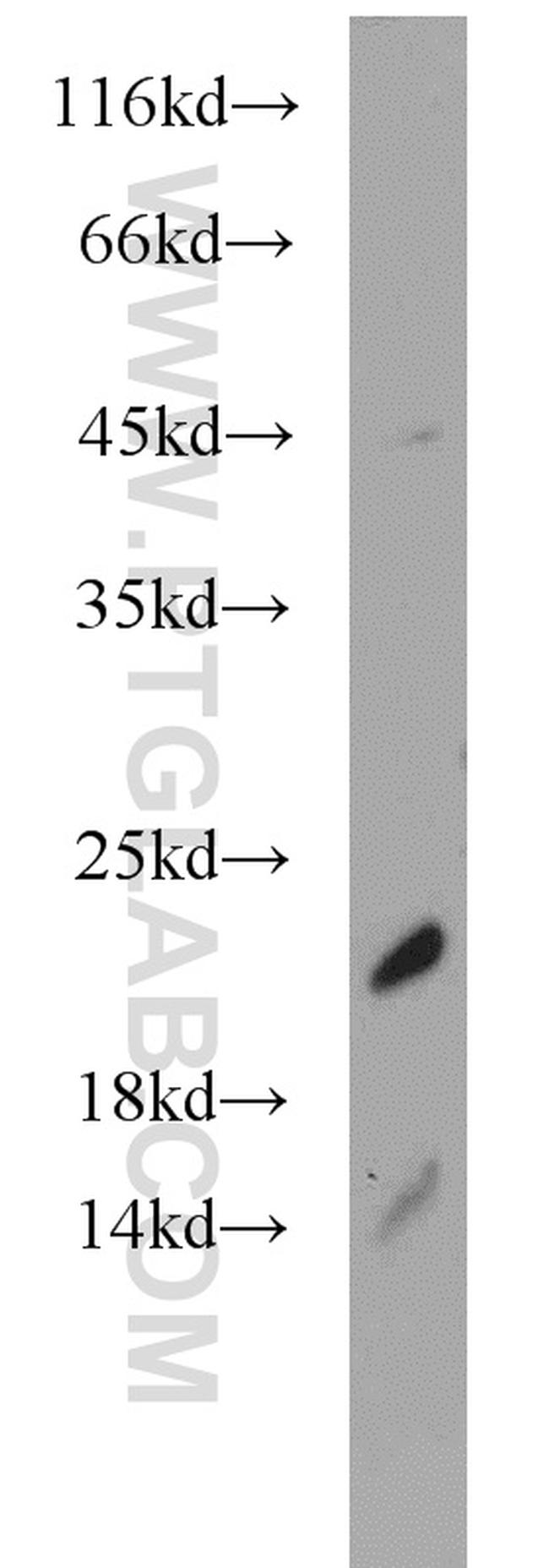 SRP19 Antibody in Western Blot (WB)