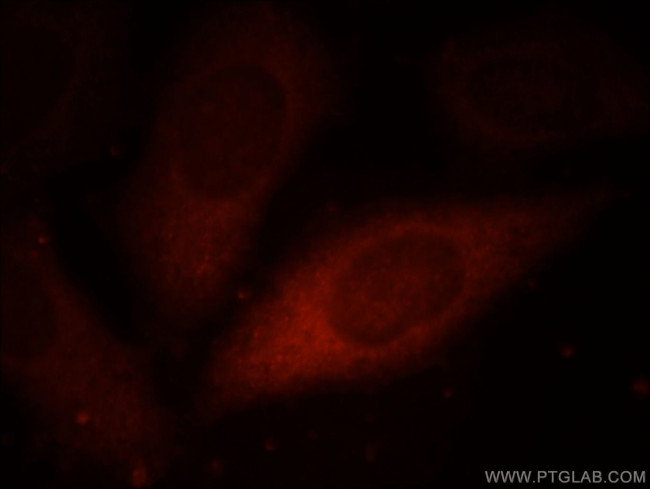 PSMD7 Antibody in Immunocytochemistry (ICC/IF)