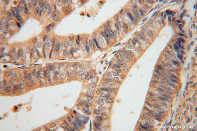 SERPINB2 Antibody in Immunohistochemistry (Paraffin) (IHC (P))