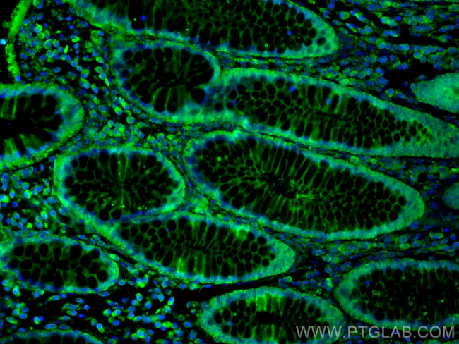 Amphiregulin Antibody in Immunohistochemistry (PFA fixed) (IHC (PFA))