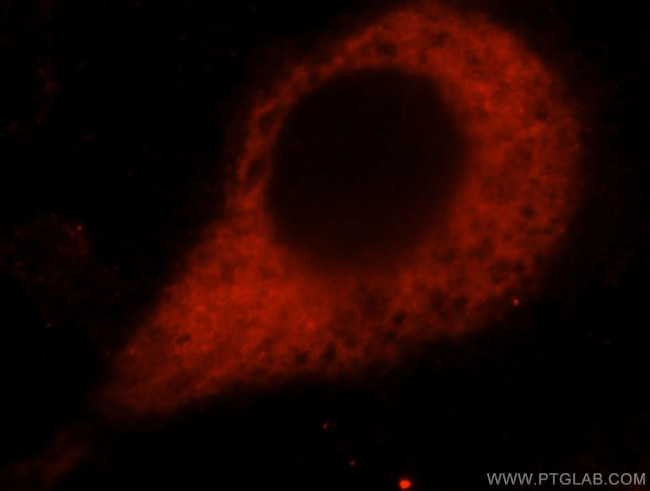 Amphiregulin Antibody in Immunocytochemistry (ICC/IF)