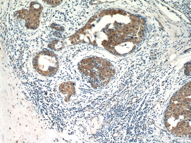 Amphiregulin Antibody in Immunohistochemistry (Paraffin) (IHC (P))