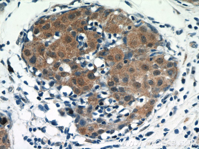 Amphiregulin Antibody in Immunohistochemistry (Paraffin) (IHC (P))