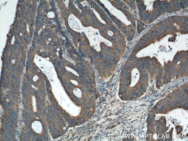 Amphiregulin Antibody in Immunohistochemistry (Paraffin) (IHC (P))