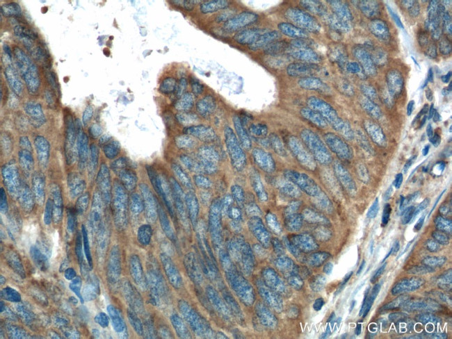 Amphiregulin Antibody in Immunohistochemistry (Paraffin) (IHC (P))