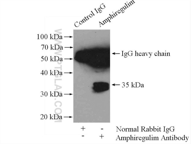 Amphiregulin Antibody in Immunoprecipitation (IP)