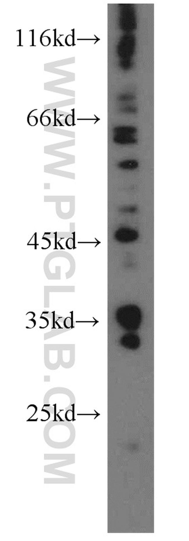 Amphiregulin Antibody in Western Blot (WB)