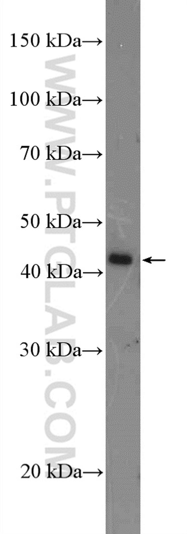 Amphiregulin Antibody in Western Blot (WB)