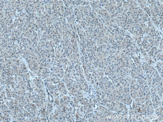 NDUFB6 Antibody in Immunohistochemistry (Paraffin) (IHC (P))