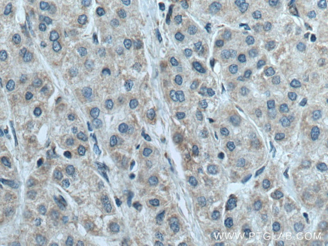 NDUFB6 Antibody in Immunohistochemistry (Paraffin) (IHC (P))