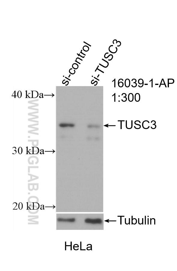 TUSC3 Antibody in Western Blot (WB)