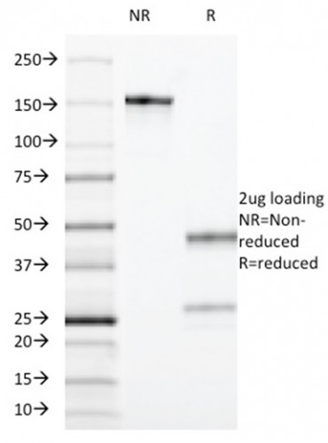 CD55/Decay Accelerating Factor (DAF) Antibody in SDS-PAGE (SDS-PAGE)