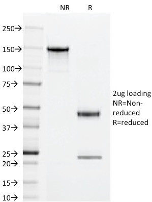 CD55/Decay Accelerating Factor (DAF) Antibody in SDS-PAGE (SDS-PAGE)