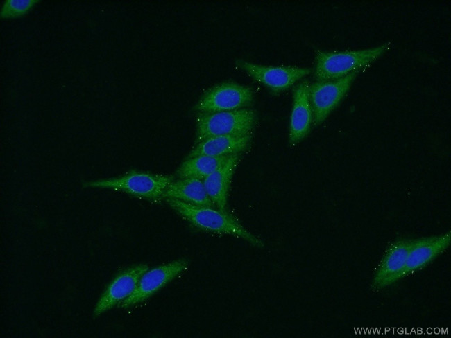 C20orf195 Antibody in Immunocytochemistry (ICC/IF)