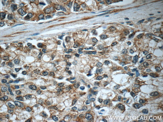 C20orf195 Antibody in Immunohistochemistry (Paraffin) (IHC (P))