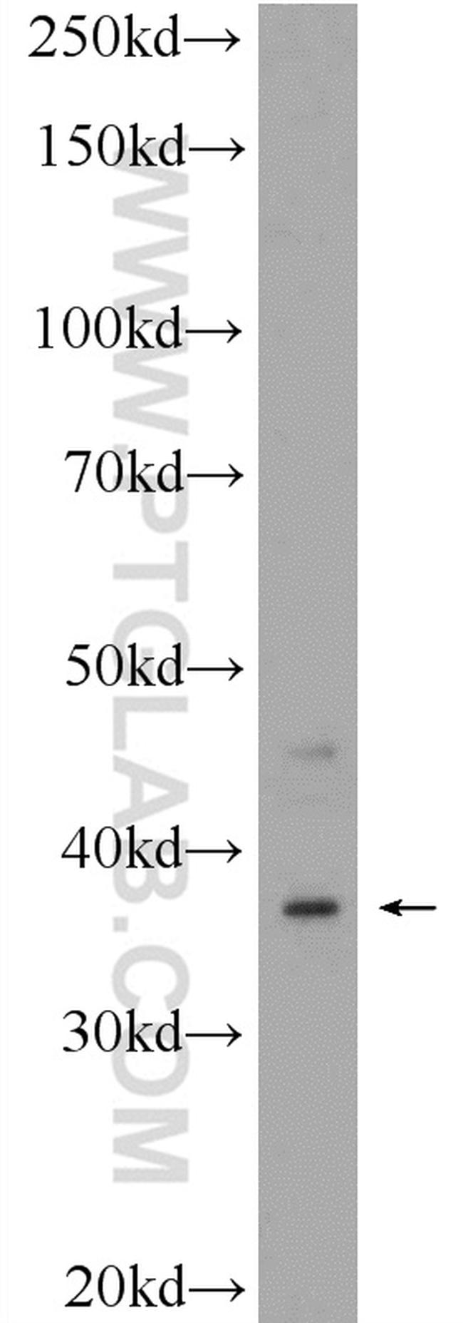 C20orf195 Antibody in Western Blot (WB)