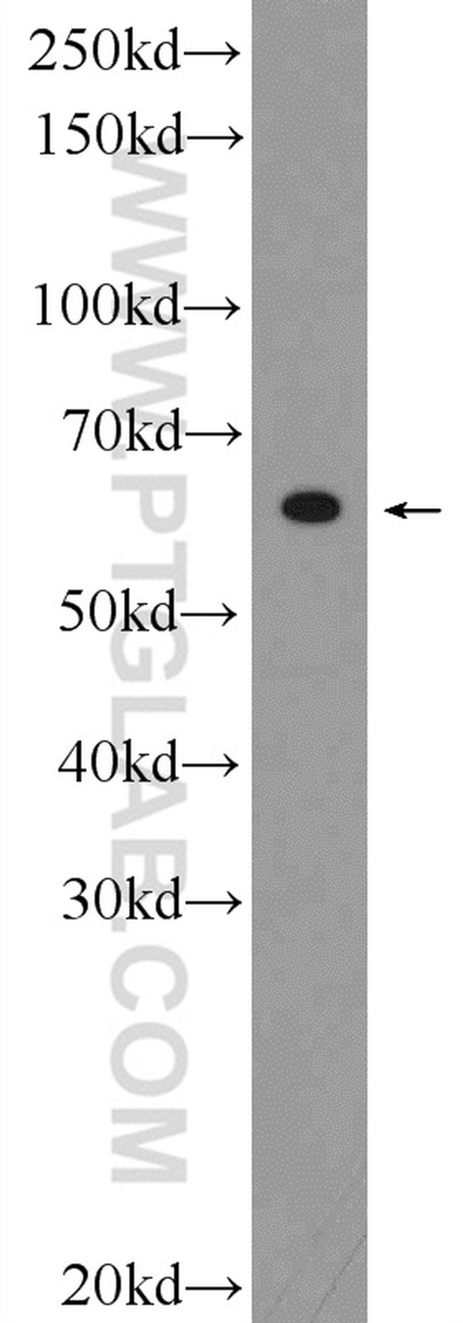 C20orf195 Antibody in Western Blot (WB)