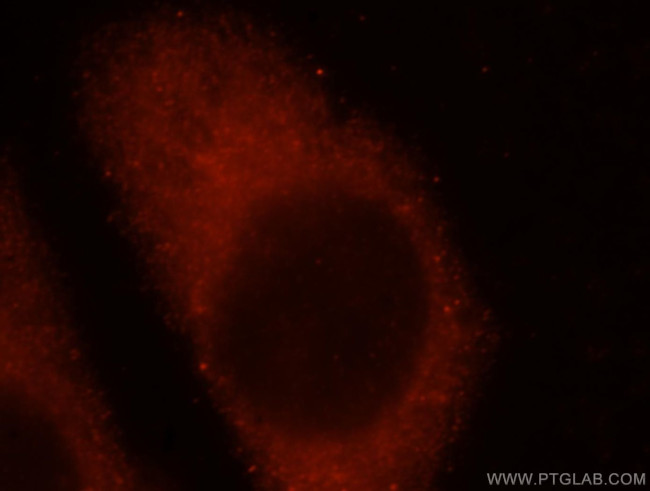 IFFO1 Antibody in Immunocytochemistry (ICC/IF)