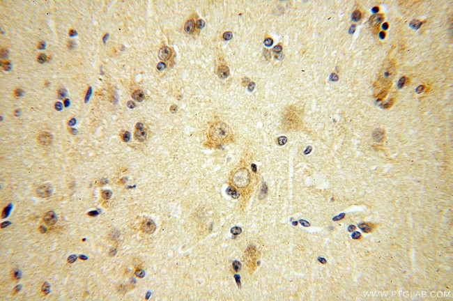 IFFO1 Antibody in Immunohistochemistry (Paraffin) (IHC (P))