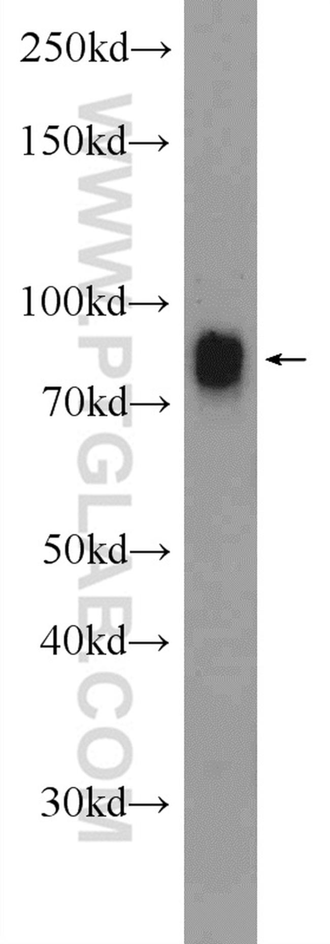 IFFO1 Antibody in Western Blot (WB)