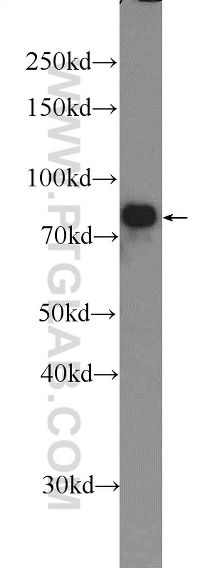 IFFO1 Antibody in Western Blot (WB)