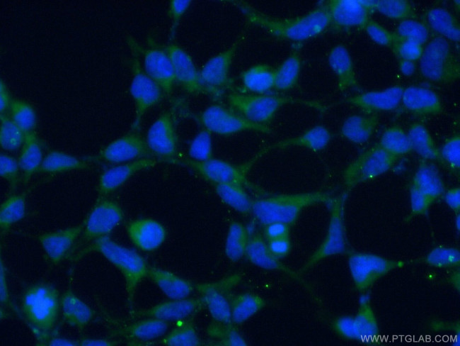 ALG5 Antibody in Immunocytochemistry (ICC/IF)