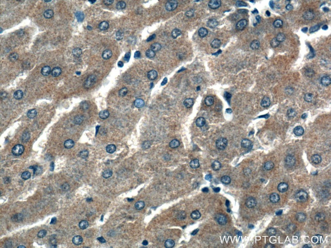 ALG5 Antibody in Immunohistochemistry (Paraffin) (IHC (P))