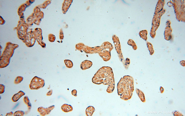 ALG5 Antibody in Immunohistochemistry (Paraffin) (IHC (P))