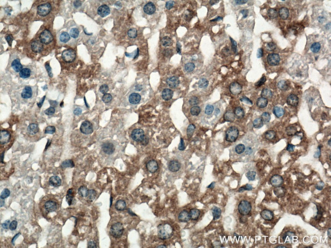 ALG5 Antibody in Immunohistochemistry (Paraffin) (IHC (P))