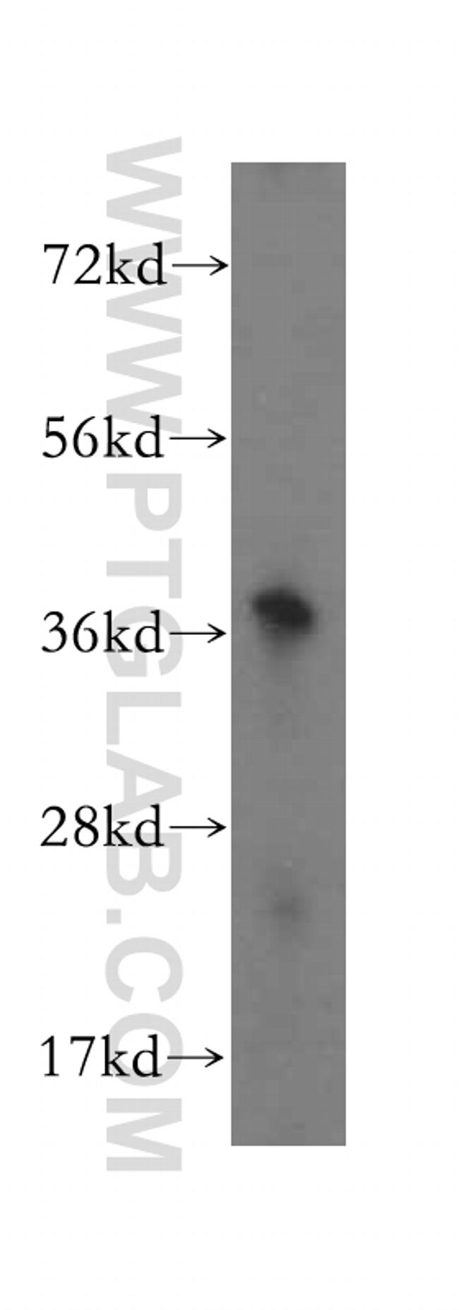 ALG5 Antibody in Western Blot (WB)