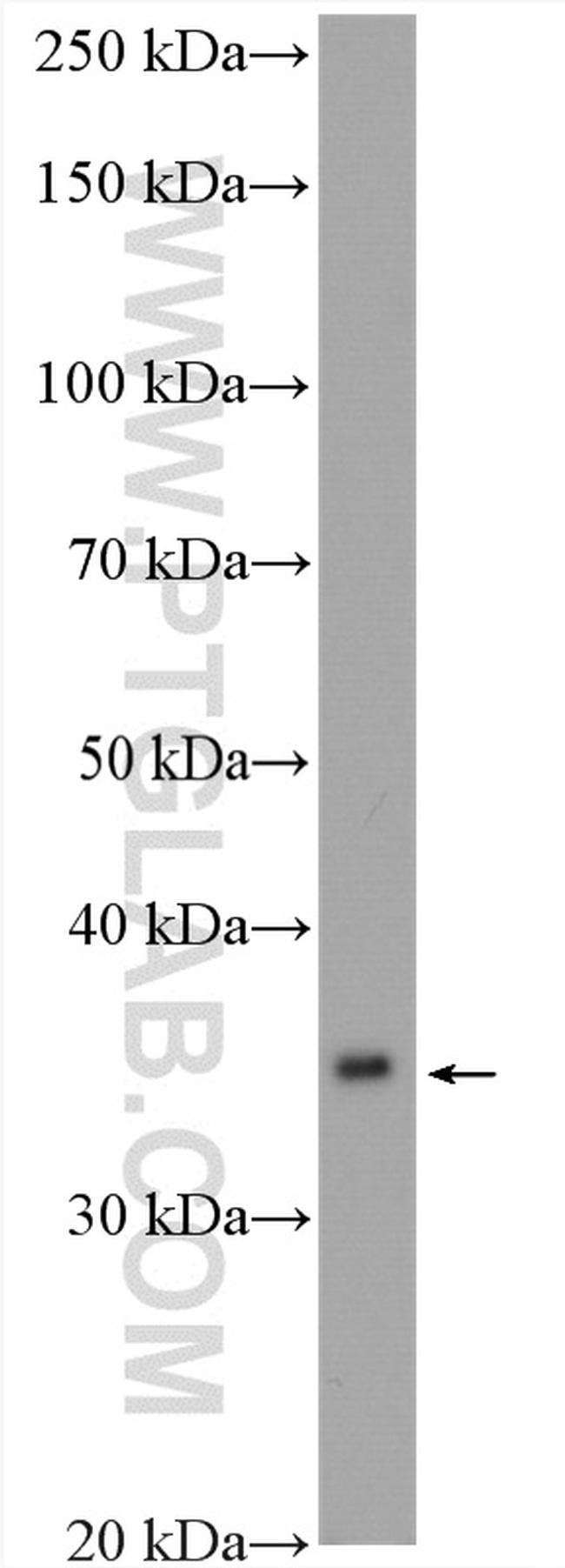 ALG5 Antibody in Western Blot (WB)