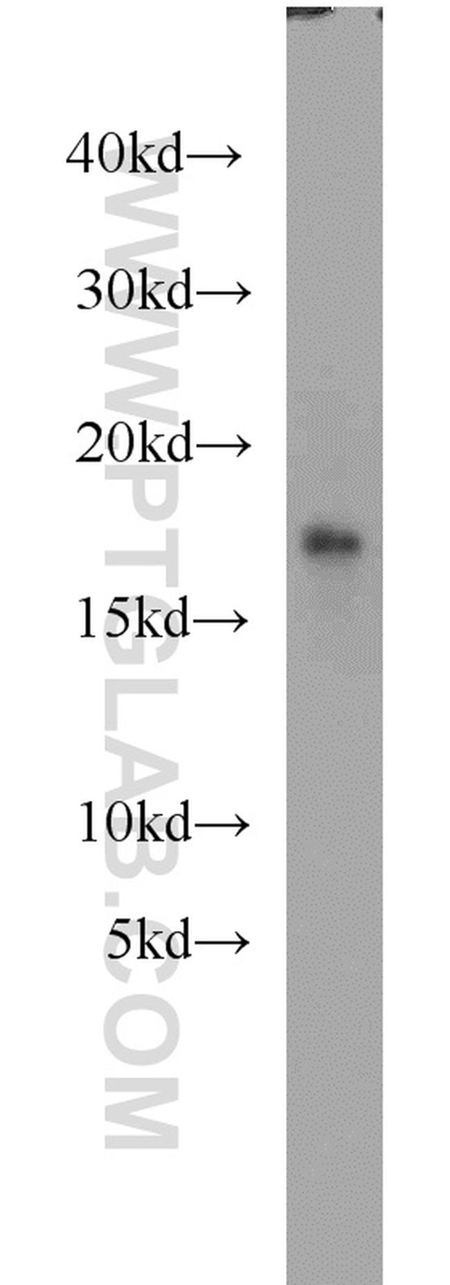 Myoglobin Antibody in Western Blot (WB)