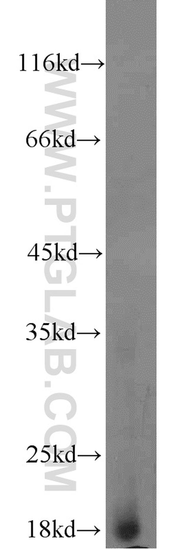 Myoglobin Antibody in Western Blot (WB)