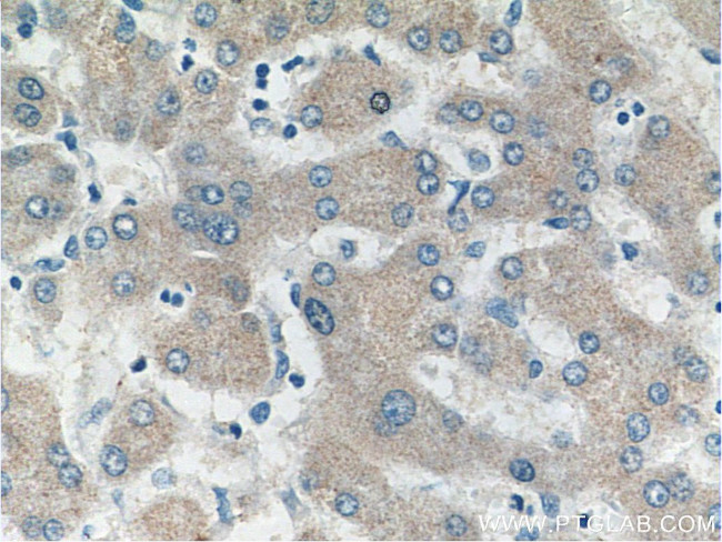 SULT1B1 Antibody in Immunohistochemistry (Paraffin) (IHC (P))
