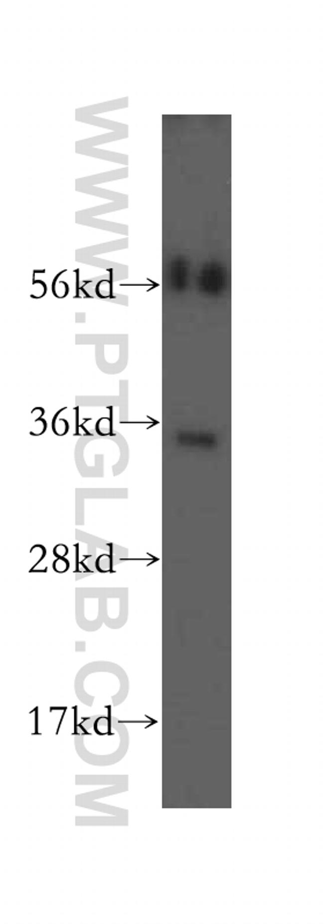 SULT1B1 Antibody in Western Blot (WB)