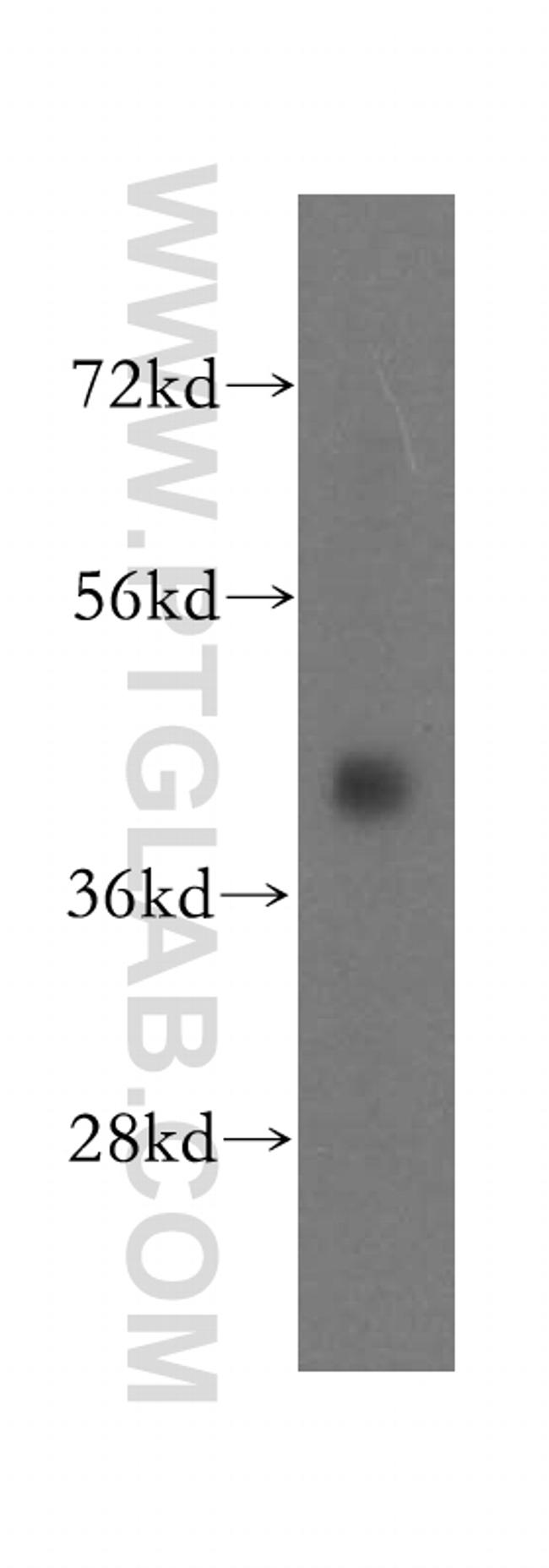 ATP6V1C1 Antibody in Western Blot (WB)