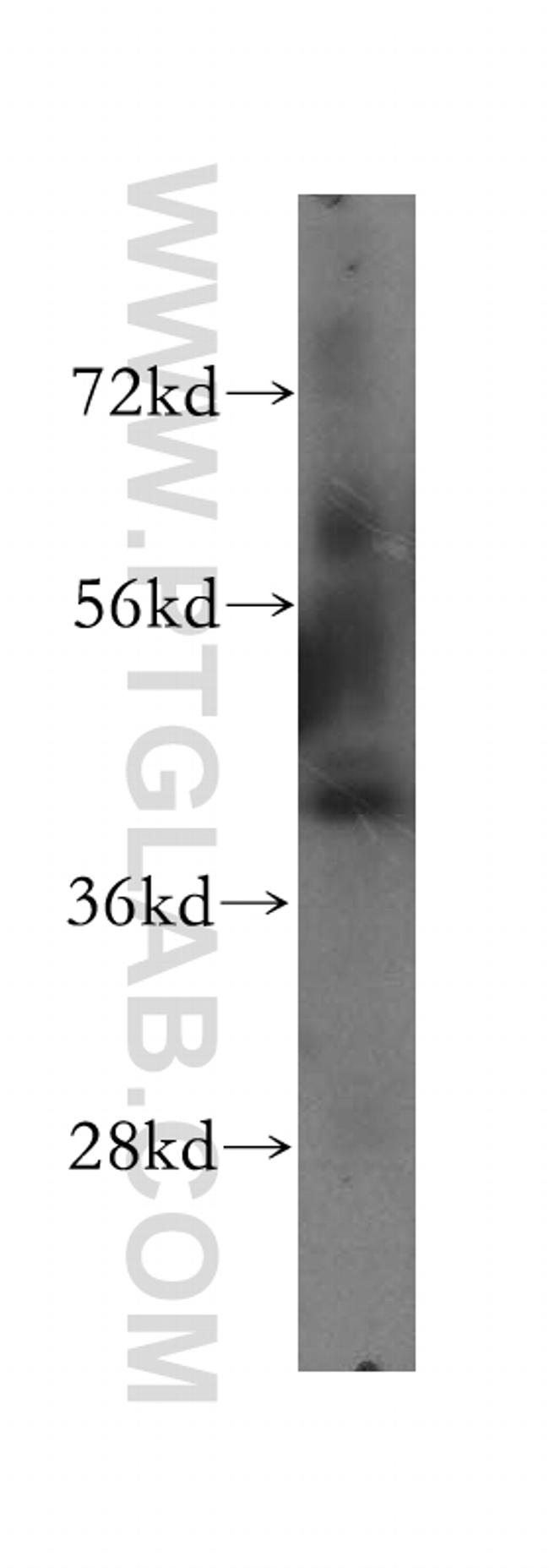 ATP6V1C1 Antibody in Western Blot (WB)