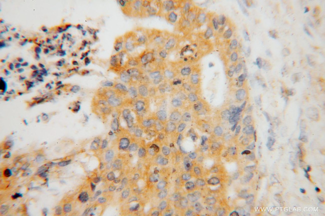 ATP6V1C1 Antibody in Immunohistochemistry (Paraffin) (IHC (P))