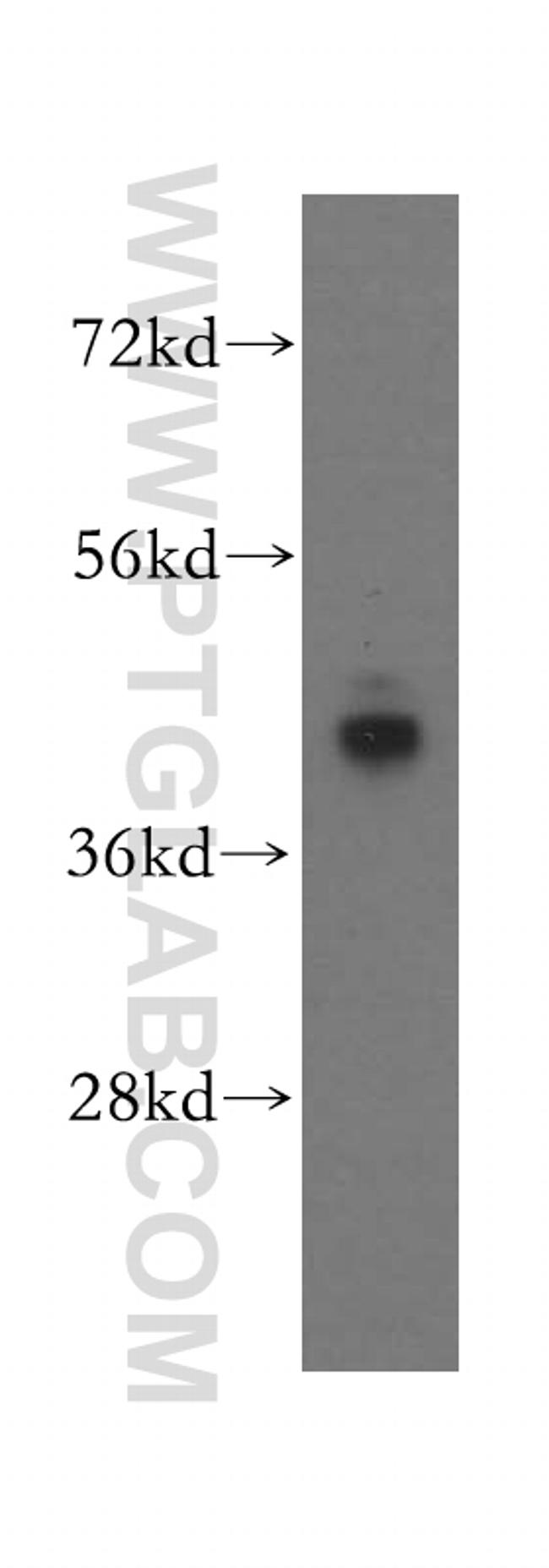 ATP6V1C1 Antibody in Western Blot (WB)