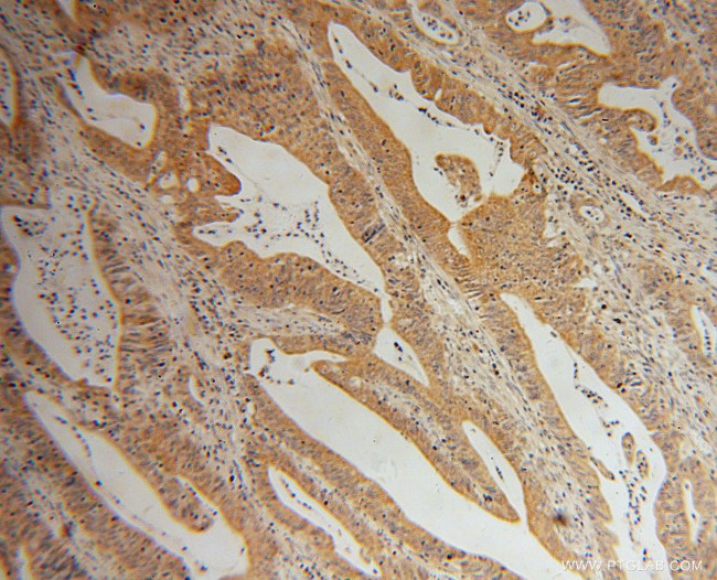 LYPLA1 Antibody in Immunohistochemistry (Paraffin) (IHC (P))