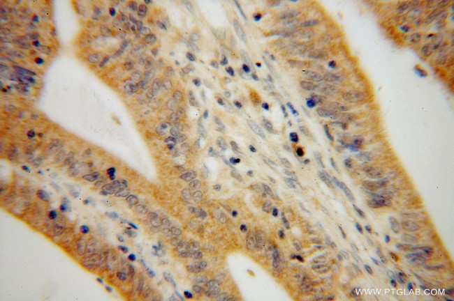 LYPLA1 Antibody in Immunohistochemistry (Paraffin) (IHC (P))