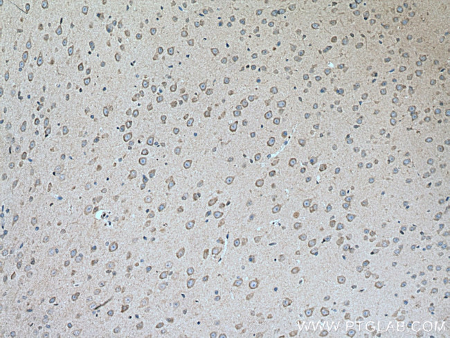 LYPLA1 Antibody in Immunohistochemistry (Paraffin) (IHC (P))